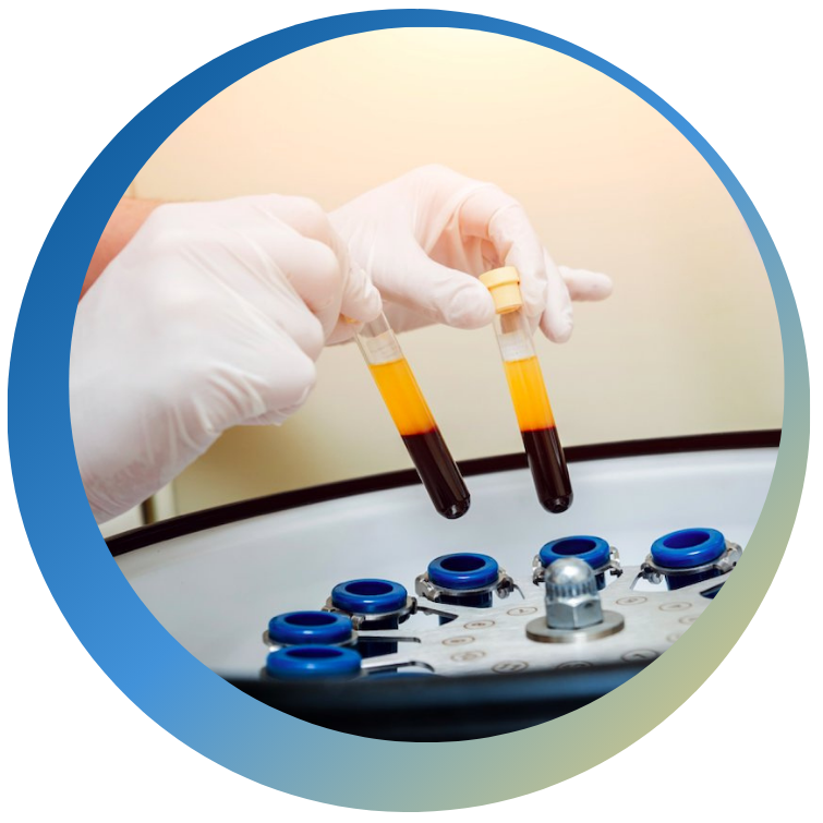 platelet-rich plasma, untitled design