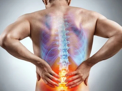 cost effective treatment of failed back surgery syndrome, untitled design